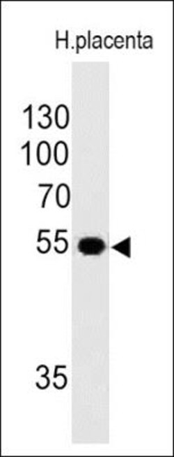 Mouse anti-Ornithine Decarboxylase, Clone: ODC1/485, Azide Free, Novus